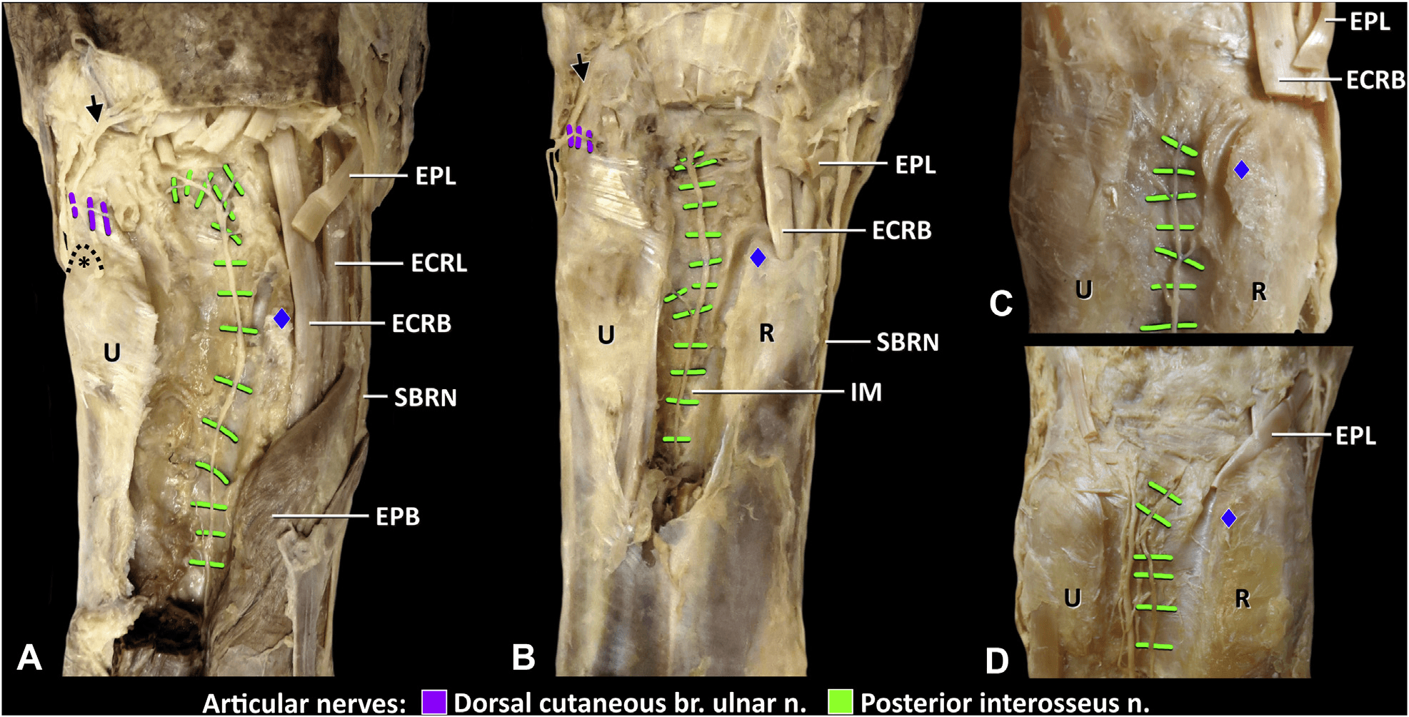 손목관절통증 논문 Figure 1 — 임상 데이터 시각화