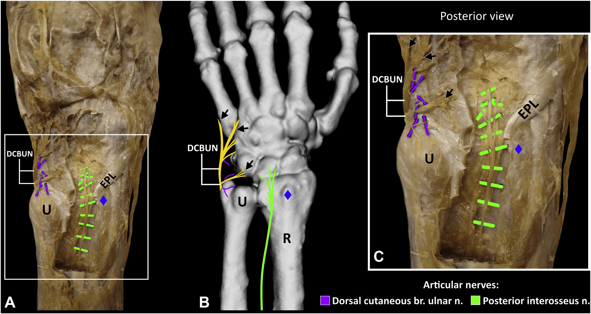 손목관절통증 논문 Figure 2 — 임상 데이터 시각화