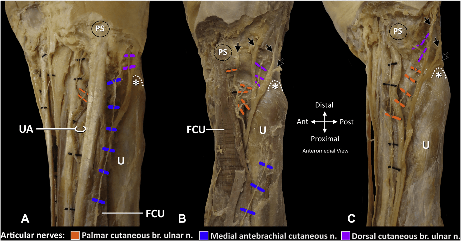 손목관절통증 논문 Figure 3 — 임상 데이터 시각화