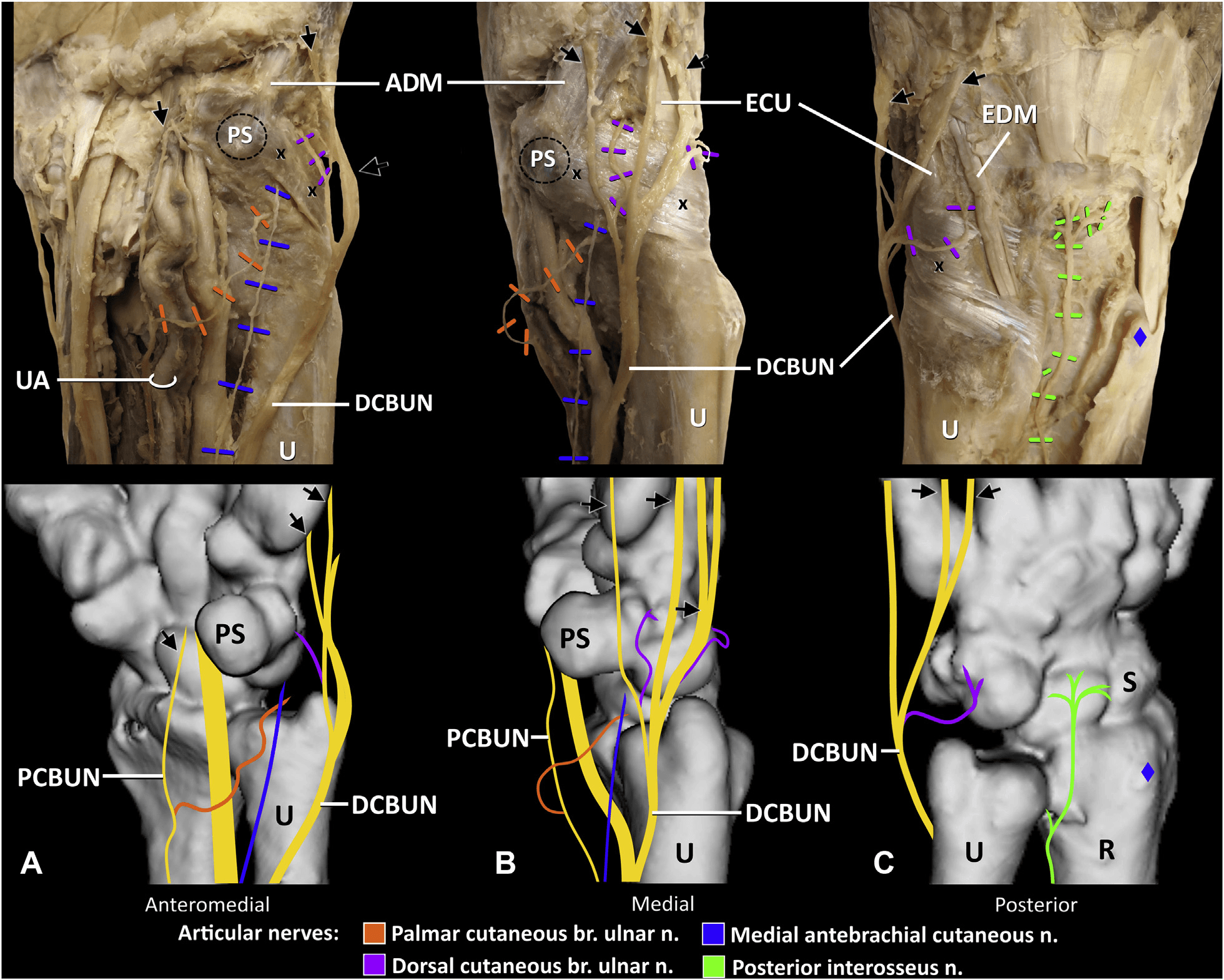 손목관절통증 논문 Figure 4 — 임상 데이터 시각화