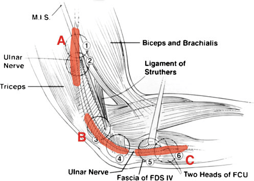 내측상과 - 주관 터널에 대한 긁기 허탈 검사(scratch collapse test), 3개 하위 분절 검사입니다. 현재 연구에서 검사된 포획 가능성이 있