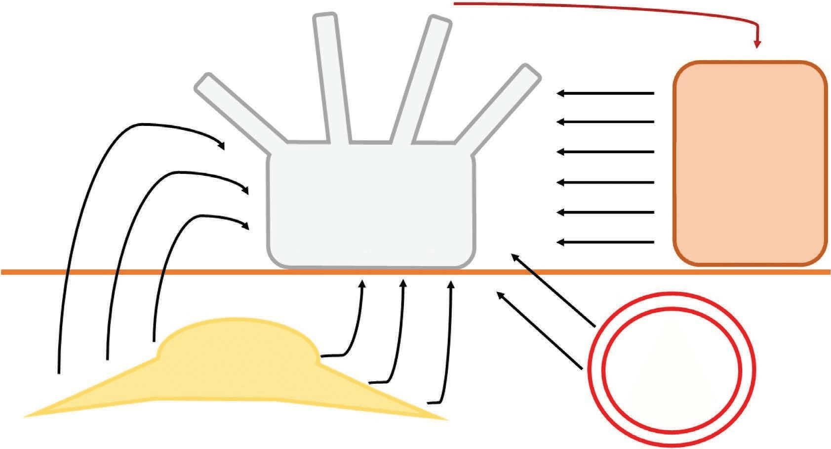 레이저치료 - 전통적인 레이저 유발 조직 백화와 색소침착후과색소침착(PUL)에서의 자반으로 인한 염증후과색소침착(PIH)입니다. 레이저 손상된 각질형성세포에서