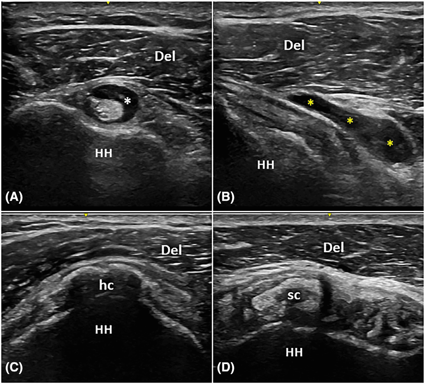 건초염 논문 Figure 1 — 임상 데이터 시각화