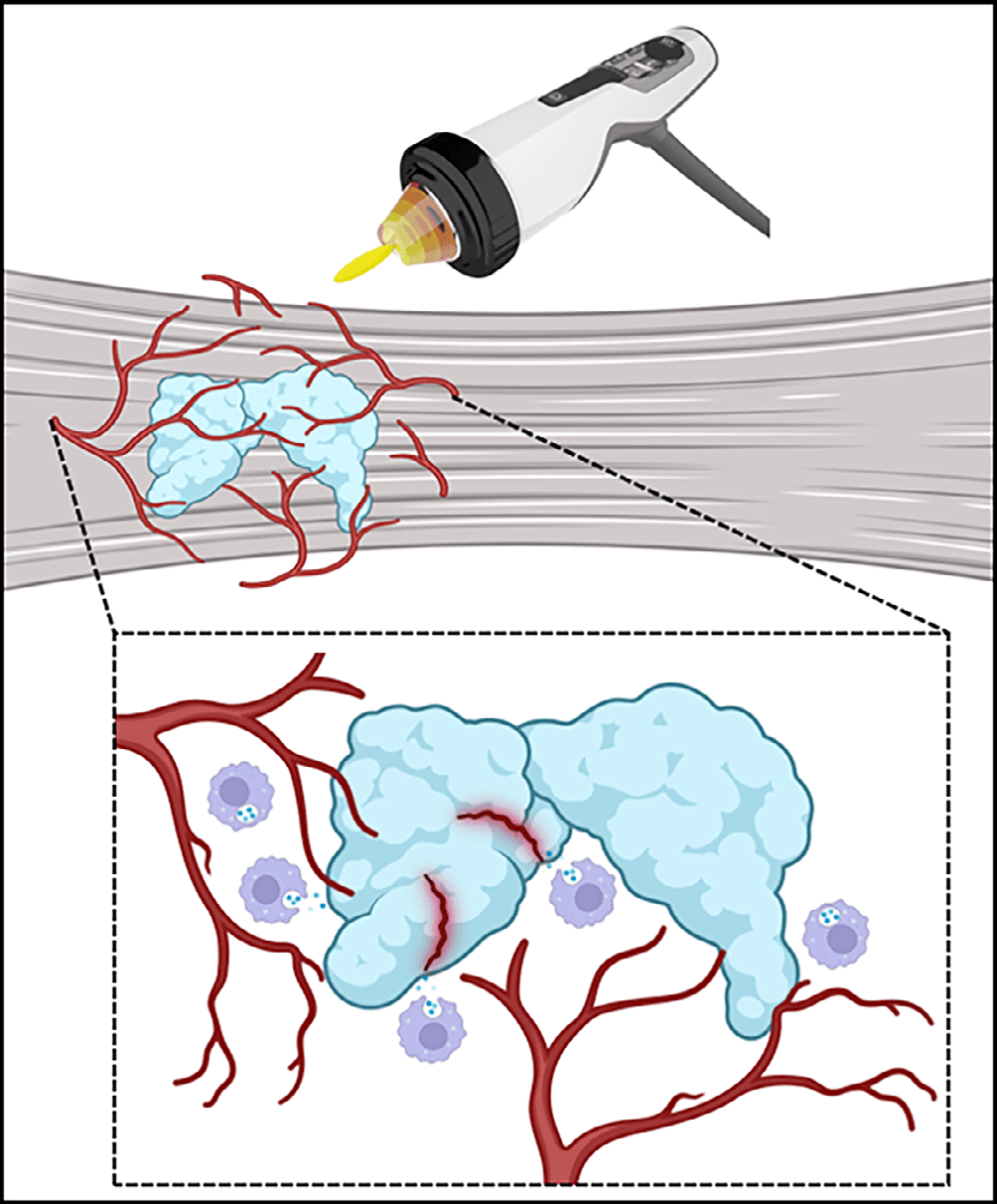 건초염 논문 Figure 3 — 임상 데이터 시각화