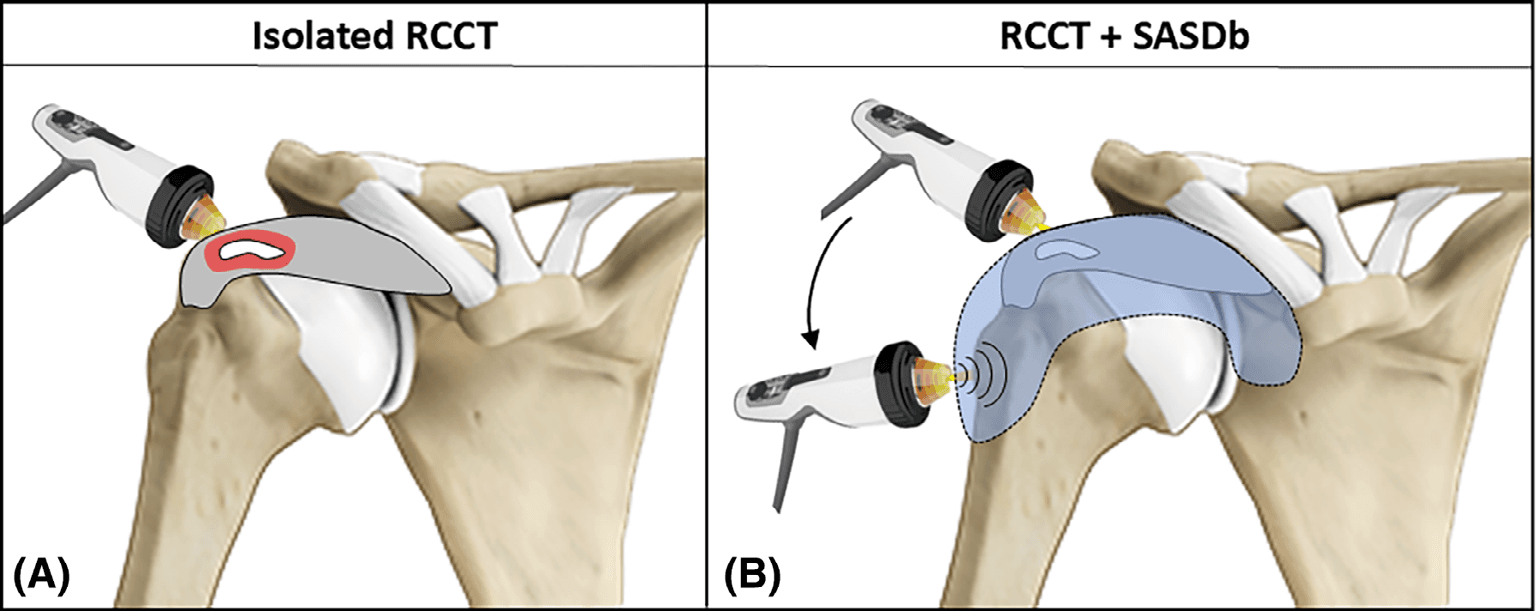 건초염 논문 Figure 4 — 임상 데이터 시각화