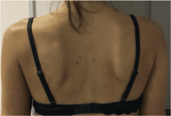 근전도검사 논문 Figure 4 — 임상 데이터 시각화