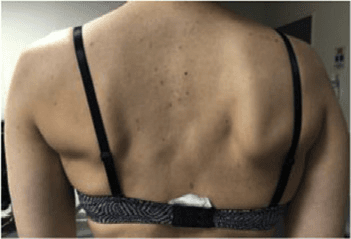 근전도검사 논문 Figure 5 — 임상 데이터 시각화