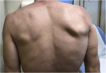 근전도검사 논문 Figure 6 — 임상 데이터 시각화