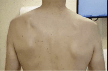 근전도검사 논문 Figure 7 — 임상 데이터 시각화