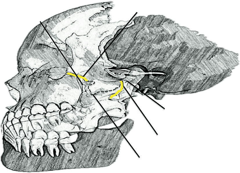 상완신경총 - Figure 7 - 원문 캡션입니다 (자동 번역 실패 — 원문 표기): Figure 7.  Doppler ultrasound imaging of 